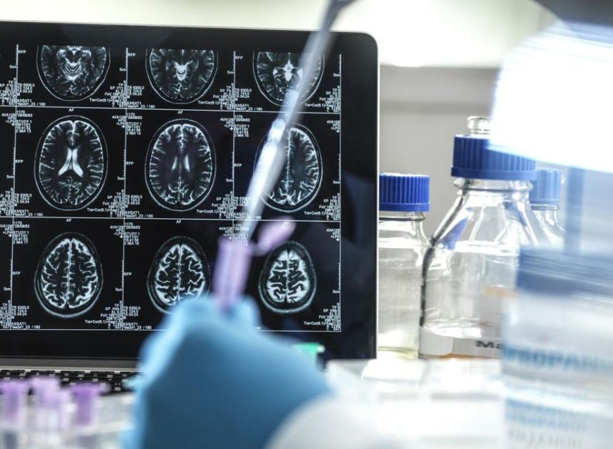Una investigación muestra la eficacia de un tratamiento con litio frente al alzhéimer en ratones