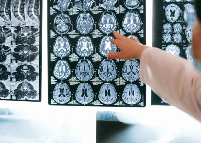 Un megaestudio muestra que los trastornos digestivos multiplican el riesgo de sufrir alzhéimer y párkinson
