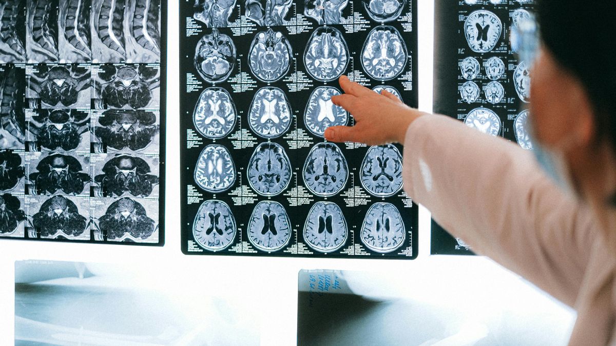 Un megaestudio muestra que los trastornos digestivos multiplican el riesgo de sufrir alzhéimer y párkinson