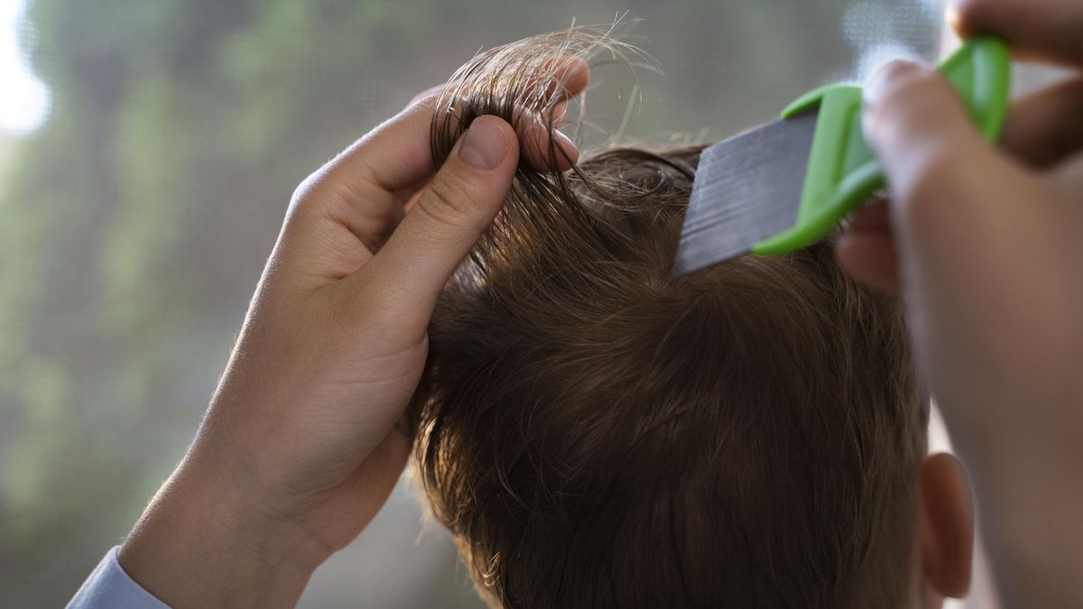 Mitos y verdades para acabar con los piojos, según una pediatra: «No prefieren el cabello sucio»