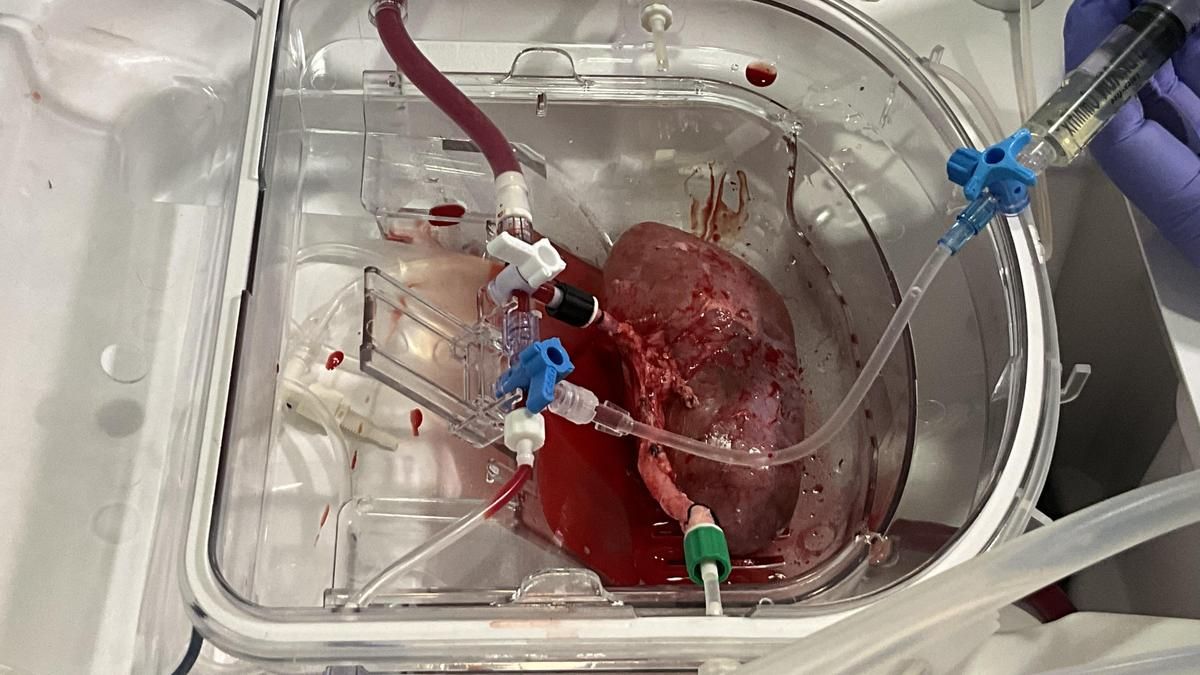 Logran el primer trasplante a cerdos de riñones porcinos modificados con organoides humanos