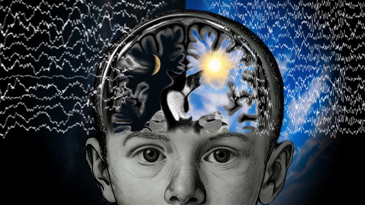 ¿Puede una sola persona albergar dos mentes? Los niños epilépticos con el ‘cerebro dividido’ tienen la respuesta