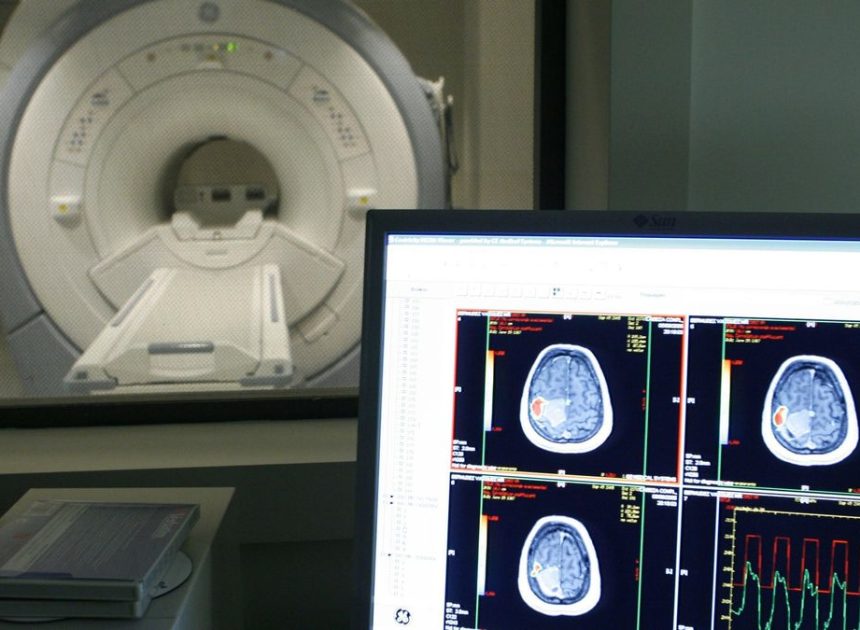 El ejercicio físico puede retrasar hasta siete años la aparición de síntomas de alzhéimer