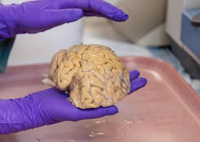 El primer mapa del cerebro en formación, un paso para entender el origen de las afecciones neurológicas