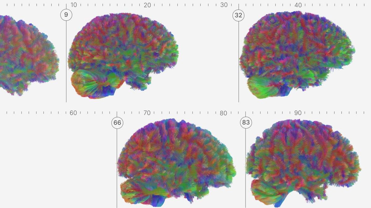 Un estudio revela que la adolescencia del cerebro dura hasta los 32 años y que la decadencia se inicia a los 66