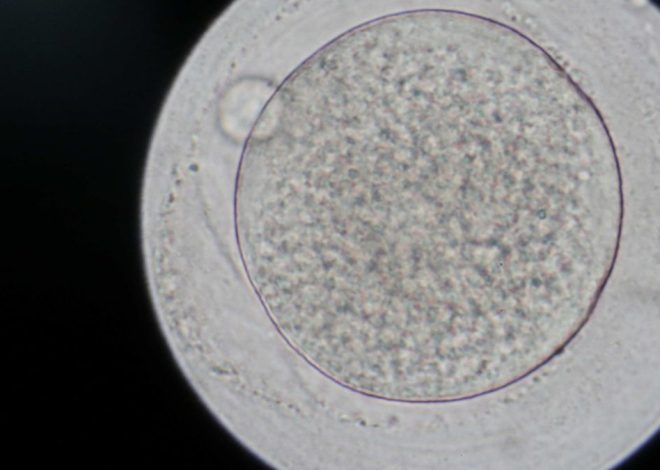 Un donante de esperma portador de un gen cancerígeno tuvo casi 200 hijos en Europa, 35 de ellos en España