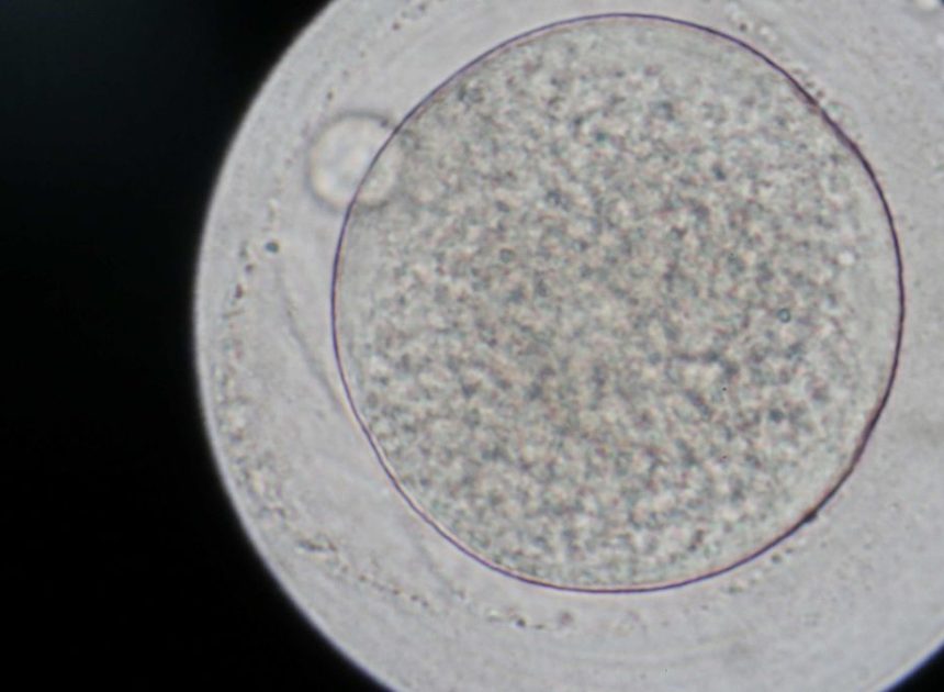 Un donante de esperma portador de un gen cancerígeno tuvo casi 200 hijos en Europa, 35 de ellos en España