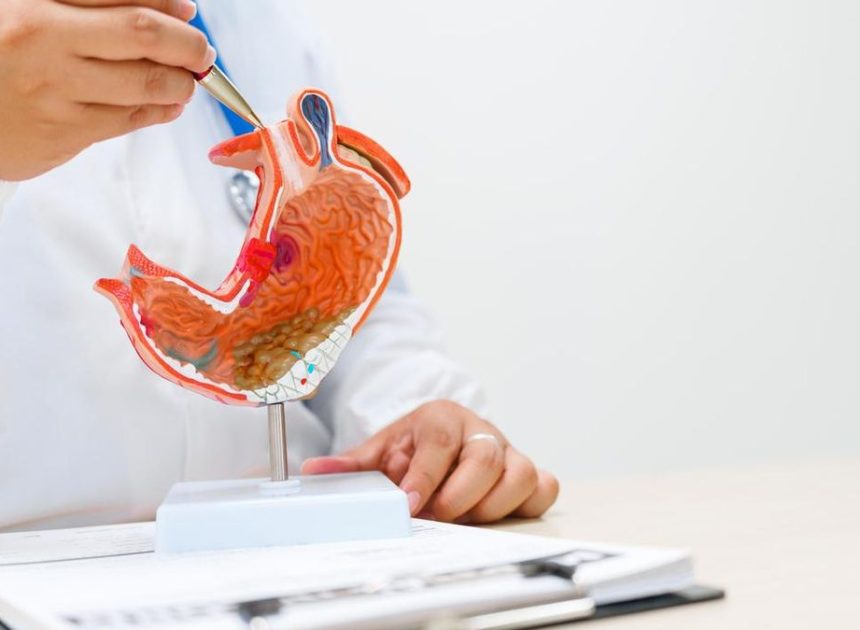 De la prevención al diagnóstico precoz: ampliar el alcance del cribado del cáncer digestivo