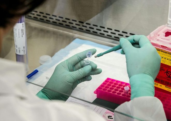 Documentan un caso especial de remisión del VIH tras un trasplante de células madre a un enfermo de cáncer