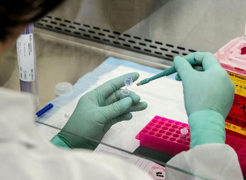 Documentan un caso especial de remisión del VIH tras un trasplante de células madre a un enfermo de cáncer