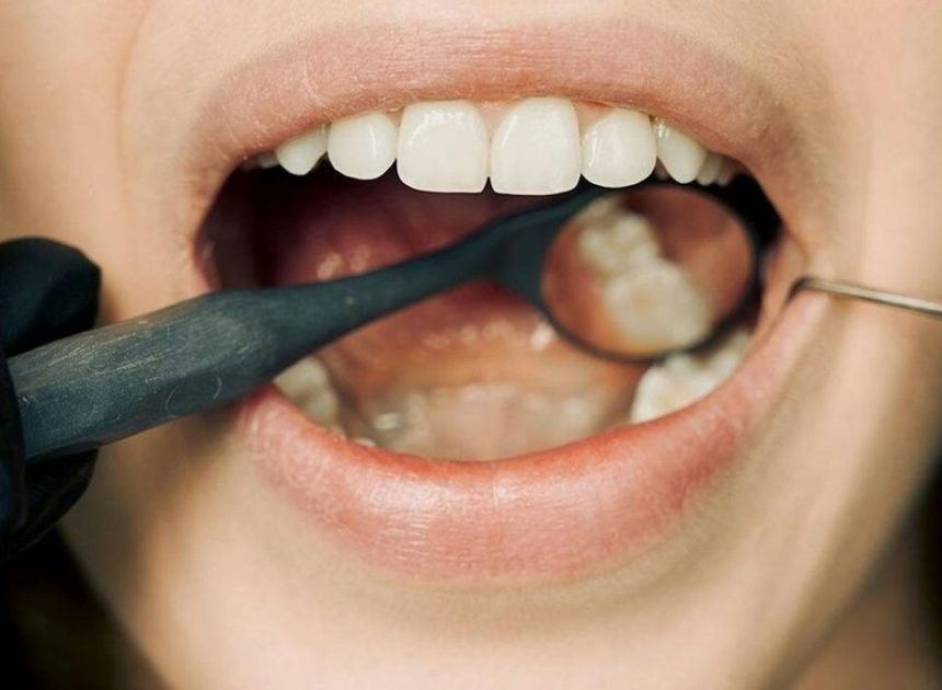 Los cinco hábitos que mantienen la salud de tu boca y otros cinco que la estropean